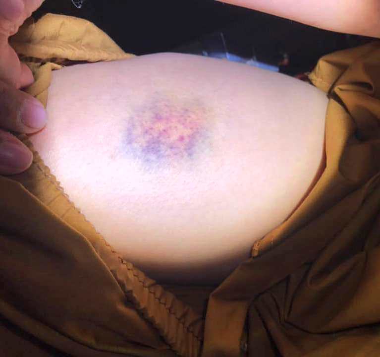 Nghi vấn cô gái bị bạn trai tra tấn như thời Trung cổ: Tiếp tục quay lại sống với người hành hạ mình?-3