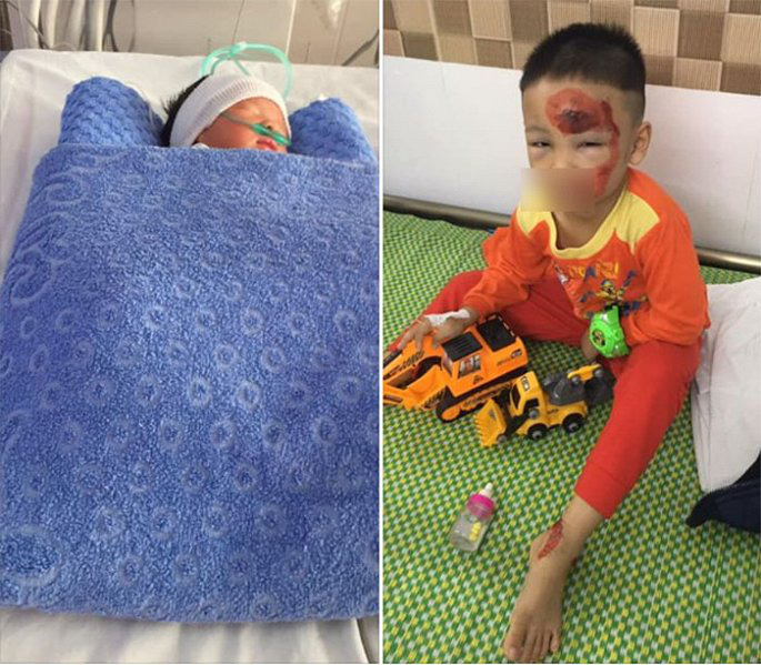 Truy tìm tài xế gây tai nạn khiến sản phụ thiệt mạng, thai nhi 34 tuần tuổi phải chào đời sớm-1