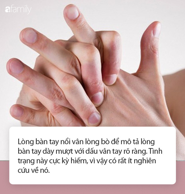 Cảnh báo: Nếu xuất hiện dấu hiệu này ở lòng bàn tay, rất có thể đã bị ung thư phổi!-3