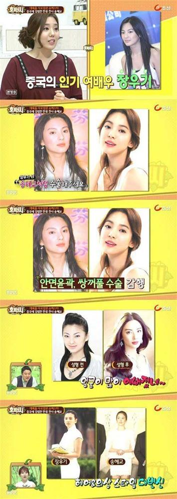 Mỹ nhân phản bội” Châu Tinh Trì: 2 cuộc hôn nhân tai tiếng, gương mặt biến dạng vì thẩm mỹ-7