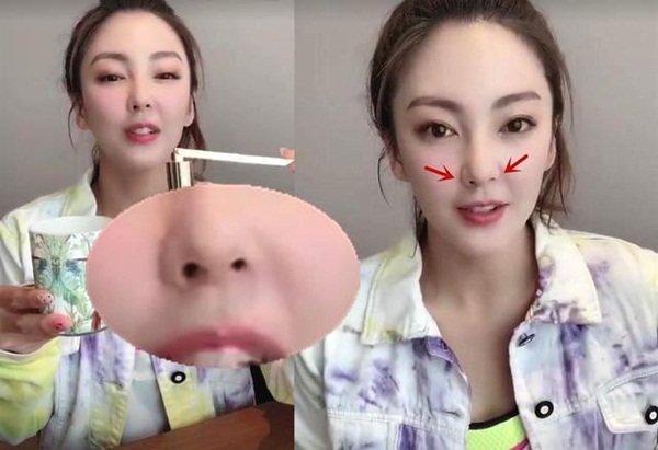 Mỹ nhân phản bội” Châu Tinh Trì: 2 cuộc hôn nhân tai tiếng, gương mặt biến dạng vì thẩm mỹ-8