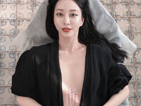 Liều lĩnh xăm màu tròng mắt, cô gái 24 tuổi suýt bị mù-4