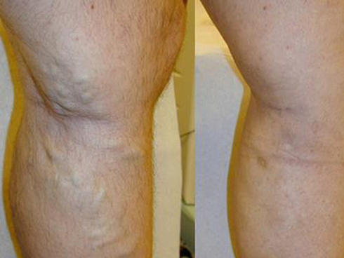 Nếu 4 điểm này của bàn chân không có dấu hiệu bất thường, chứng tỏ cơ thể bạn rất khỏe mạnh-4