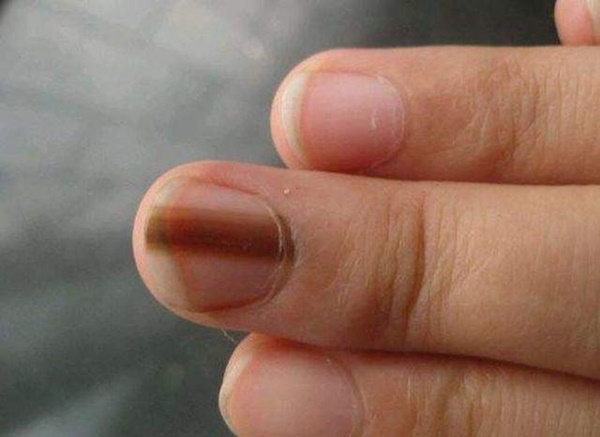 Nếu cơ thể xuất hiện 3 màu đen, 2 mùi hôi”, bạn nên đi kiểm tra gan ngay lập tức-2