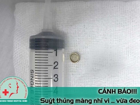 Hy hữu: Bệnh nhân nam suýt thủng màng nhĩ vì đeo tai nghe nghe nhạc khi ngủ