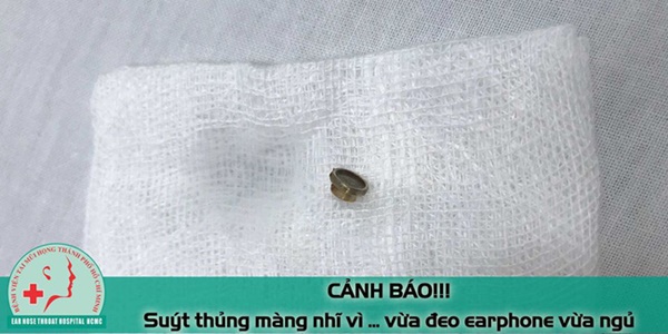 Hy hữu: Bệnh nhân nam suýt thủng màng nhĩ vì đeo tai nghe nghe nhạc khi ngủ-1