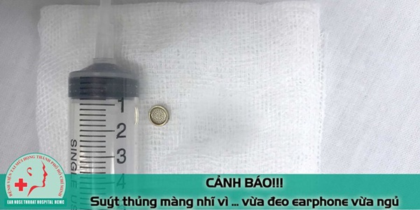 Hy hữu: Bệnh nhân nam suýt thủng màng nhĩ vì đeo tai nghe nghe nhạc khi ngủ-2