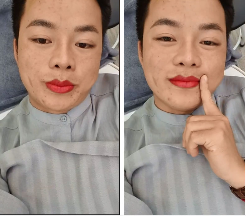 Không chỉ đưa chồng đi làm mũi, cô dâu 62 tuổi còn chơi lớn rủ ông xã cùng đi xăm môi đỏ chót gây ngỡ ngàng-2