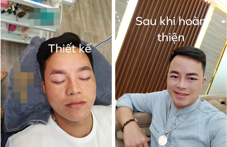 Không chỉ đưa chồng đi làm mũi, cô dâu 62 tuổi còn chơi lớn rủ ông xã cùng đi xăm môi đỏ chót gây ngỡ ngàng-3