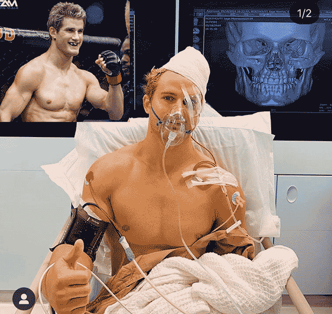 Em trai ăn đấm vỡ mặt, mỹ nhân võ thuật tấn công” sàn MMA châu Á-2