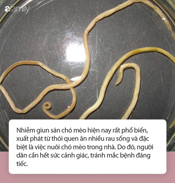 Loại giun sán khiến nhiều người dân ở Khánh Hòa phải nhập viện thực sự đáng sợ thế nào?-2