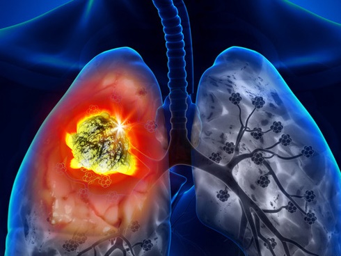 Hút thuốc trong thang máy, lại còn ngang nhiên thách thức người bên cạnh, nam thanh niên lãnh đủ vì thái độ xấc láo của bản thân-3