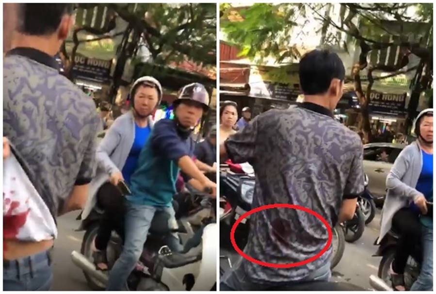 Người đàn ông bị thanh niên mặc áo Grab đâm trúng lưng khi can ẩu đả sau va chạm giao thông-4