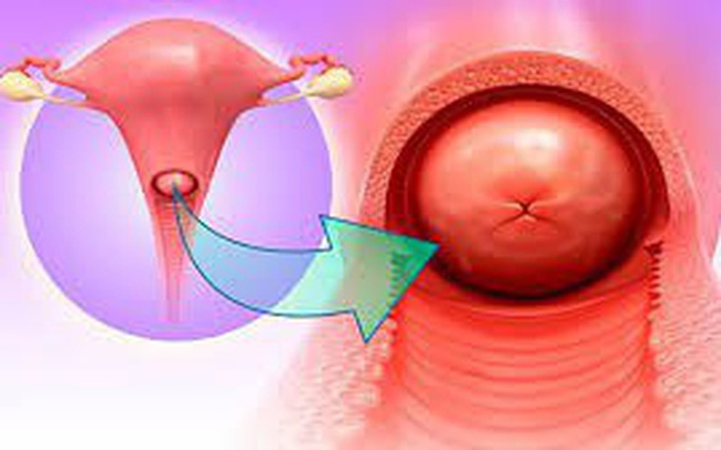 Sau khi quan hệ vợ chồng, phụ nữ không nên vội vàng làm 3 chuyện này nếu không muốn gây hại tử cung, khó có con-3