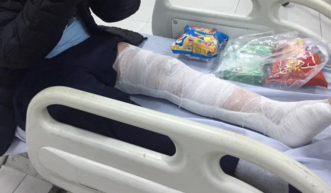 Sự thật về thông tin 2 cháu bé ngồi sau xe mẹ ngã gãy chân vì bị thanh niên thòng dây vào cổ-1