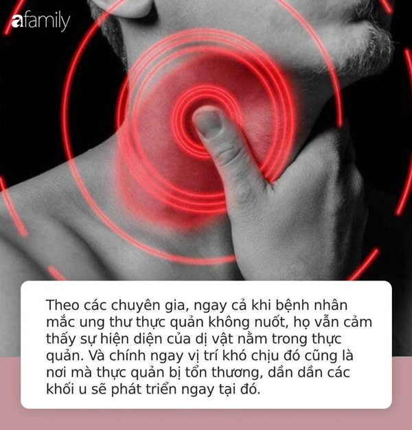 Thấy 6 dấu hiệu lạ này ở cổ họng, bạn phải tới bác sĩ ngay bởi có thể đã mắc ung thư thực quản-3