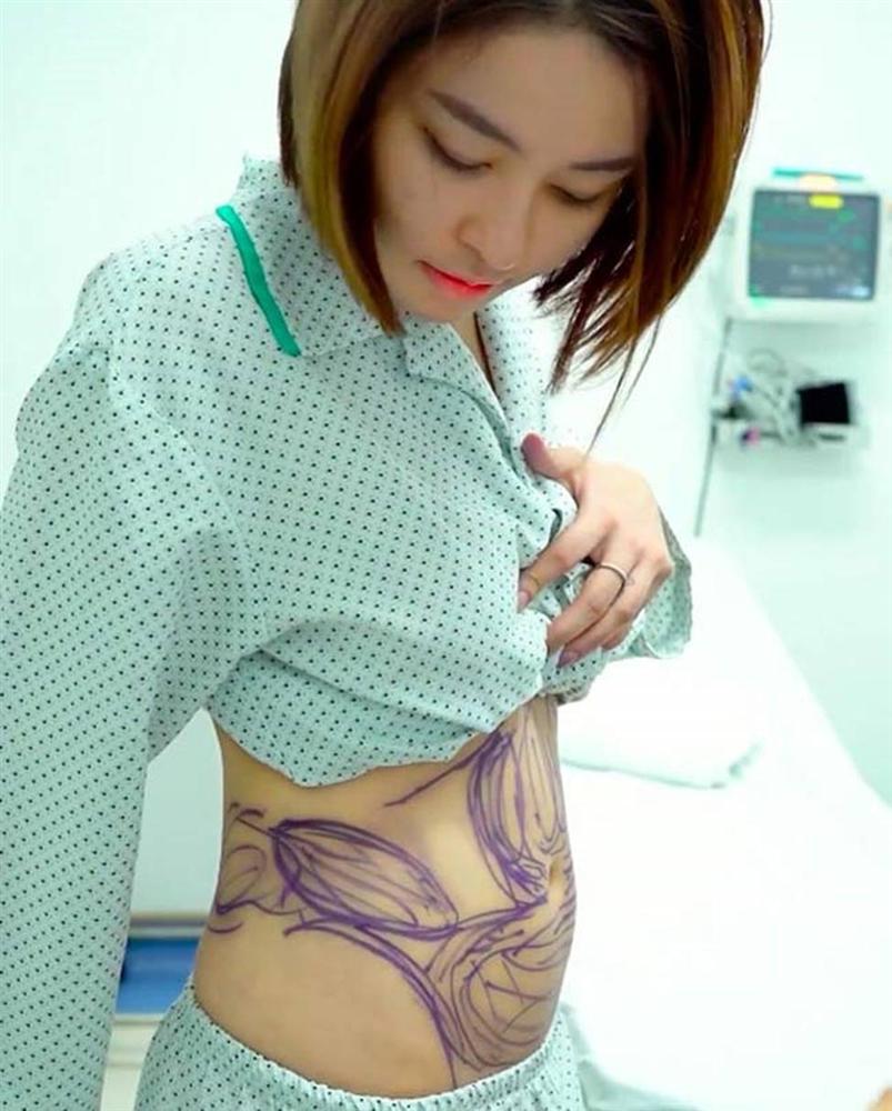 Hot girl Trâm Anh, Thúy Vi, Phi Thanh Vân vẫn mũm mĩm dù đã phẫu thuật hút mỡ bụng-2