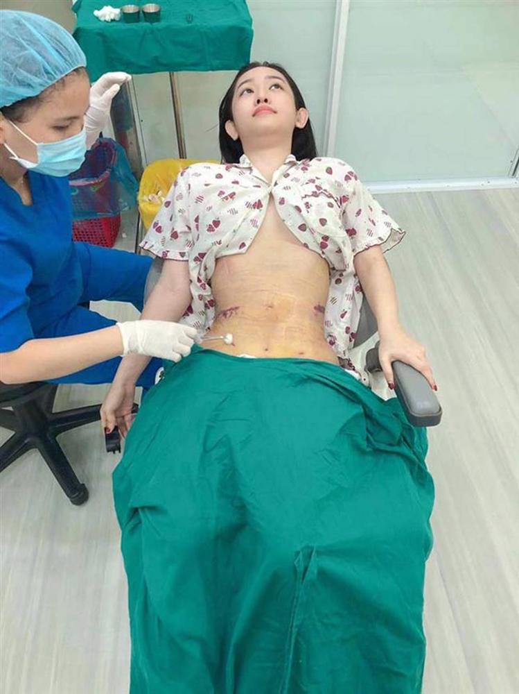 Hot girl Trâm Anh, Thúy Vi, Phi Thanh Vân vẫn mũm mĩm dù đã phẫu thuật hút mỡ bụng-9