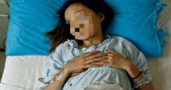 Cô gái 26 tuổi ung thư dạ dày do thường ăn đồ rẻ tiền để tiết kiệm mua mỹ phẩm-1