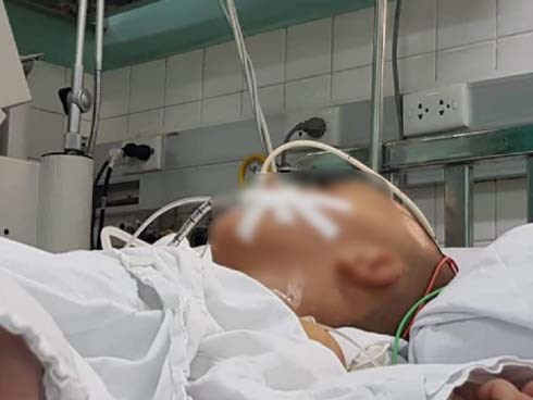 Bé trai 4 tuổi chấn thương sọ não nguy kịch nghi do bạo hành, cha dượng nói 'té vào đống gạch'