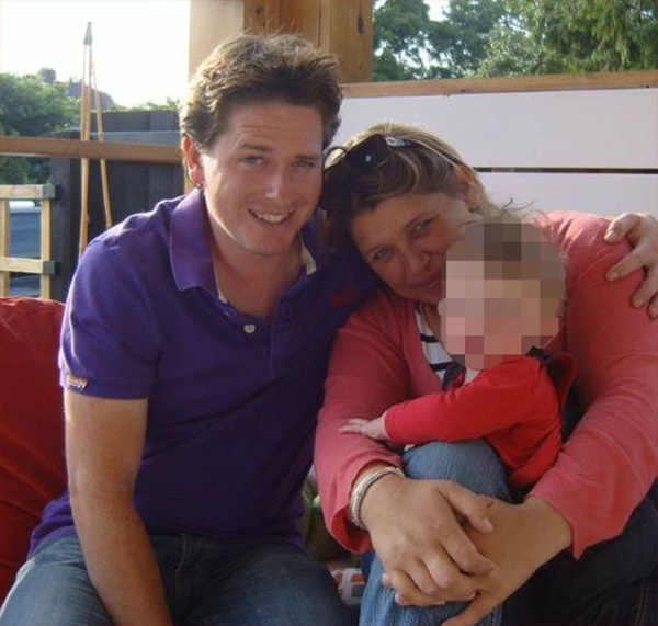 Người đàn ông phải cắt bỏ môi và tứ chi vì nghĩ mình bị cảm cúm thông thường-1