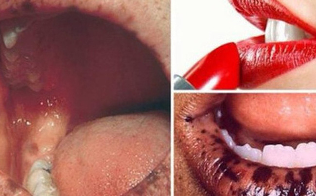 Hết kem trộn lại đến son trộn được rao bán tràn lan trên MXH: Kinh hãi với những tác hại khôn lường khi đôi môi bị tẩm” đầy hóa chất độc hại!-4
