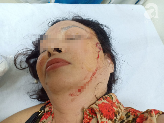 Ám ảnh người phụ nữ ly hôn 3 năm vẫn bị chồng cũ bạo hành và làm nhục cả gia đình; sống không yên, trốn không được phải vác đơn cầu cứu-3