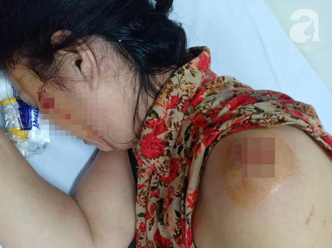 Ám ảnh người phụ nữ ly hôn 3 năm vẫn bị chồng cũ bạo hành và làm nhục cả gia đình; sống không yên, trốn không được phải vác đơn cầu cứu-4