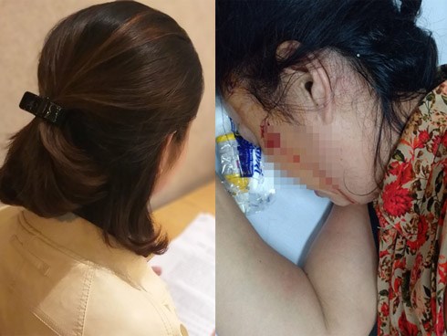 Ám ảnh người phụ nữ ly hôn 3 năm vẫn bị chồng cũ bạo hành và làm nhục cả gia đình; sống không yên, trốn không được phải vác đơn cầu cứu