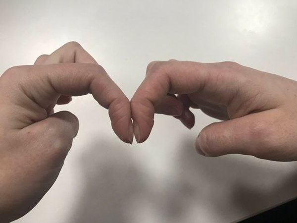 Nhờ bài kiểm tra đơn giản với móng tay, bạn có thể sớm nhận biết mình có bị ung thư phổi hay không-1