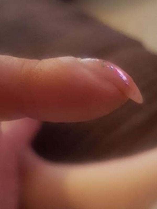 Nhờ bài kiểm tra đơn giản với móng tay, bạn có thể sớm nhận biết mình có bị ung thư phổi hay không-2