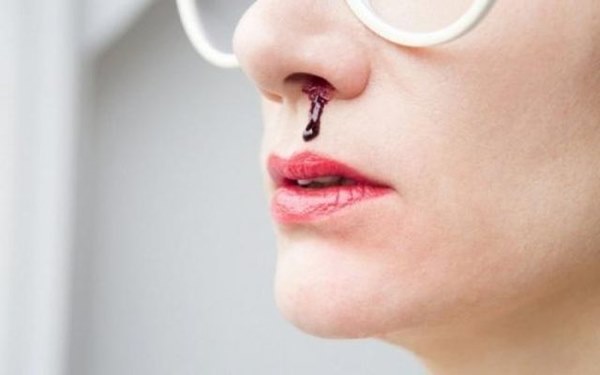 3 triệu chứng khó chịu khi ngủ cảnh báo bệnh nhồi máu não-3