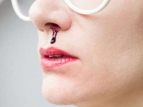 Bé trai bị sốt cao, đang đi thì ngã khuỵu, bố mẹ không ngờ con bị u não dù bác sĩ chỉ chẩn đoán là sốt thông thường-4