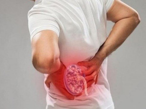 Nếu có 5 dấu hiệu này, nên đi khám thận ngay kẻo bên trong chứa đầy sỏi mà không biết
