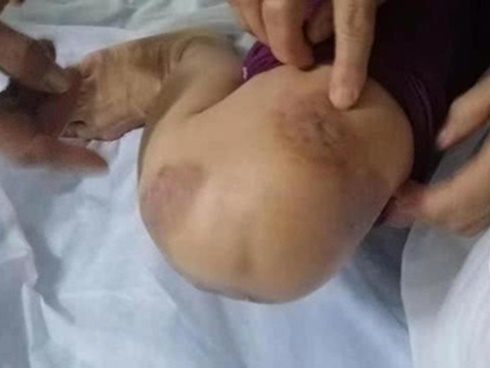 Mai là ngày đi uống vitamin A miễn phí, các mẹ có con từ 6 tháng tuổi trở lên nhớ cho con đi uống đầy đủ-3