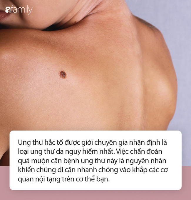 Đau nửa đầu kéo dài tưởng chỉ bị cúm, cô gái trẻ ngã ngửa khi biết mình đã bị ung thư ăn cả vào gan, phổi, xương...-6