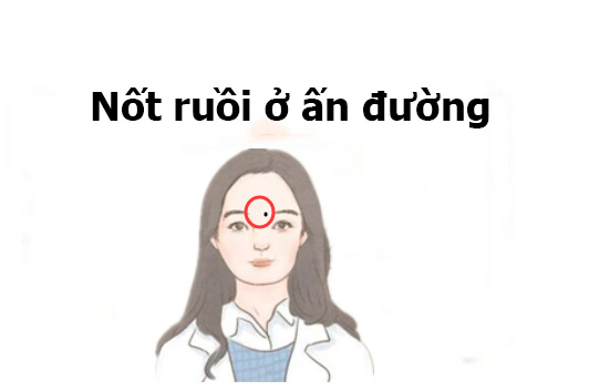 Đây là 4 nốt ruồi hoàng kim trên khuôn mặt, phụ nữ sở hữu phúc tướng này cả đời không lo thiếu tiền-2