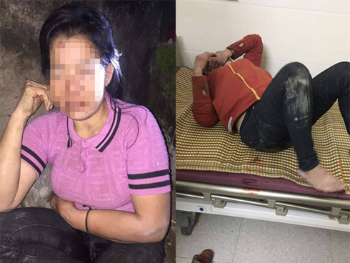 Phi công trẻ” dùng thanh sắt đâm vào vùng kín của người tình khai gì tại CQĐT?-2