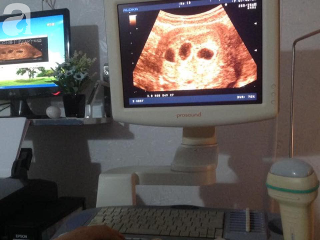 Cưới được 2 tháng đã ly hôn vì chồng ngoại tình, người phụ nữ bỏ 200 triệu để thụ tinh nhân tạo, sinh đôi con lai Tây bất chấp việc gia đình cấm đường về quê-2