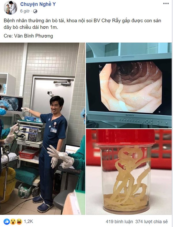 Kinh hãi hình ảnh sán dây bò dài cả mét kéo ra từ bụng bệnh nhân, hãy cảnh giác khi ăn những món khoái khẩu này!-1