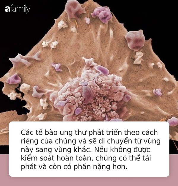 Dù đã được điều trị, tế bào ung thư vẫn có thể phát triển rầm rộ trở lại vì 3 lý do này-3