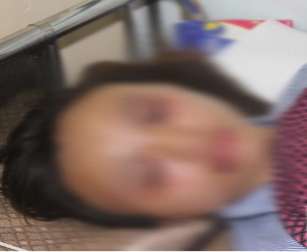 Bắc Giang: Công an vào cuộc điều tra vụ bố đẻ đánh con gái nhập viện khi đi chơi về muộn-1
