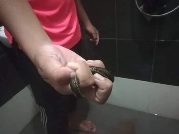 Đưa con trai bị nôn ra máu đi bệnh viện, cả nhà rùng mình khi nhìn thấy thứ này được gắp ra khỏi cơ thể bé-3