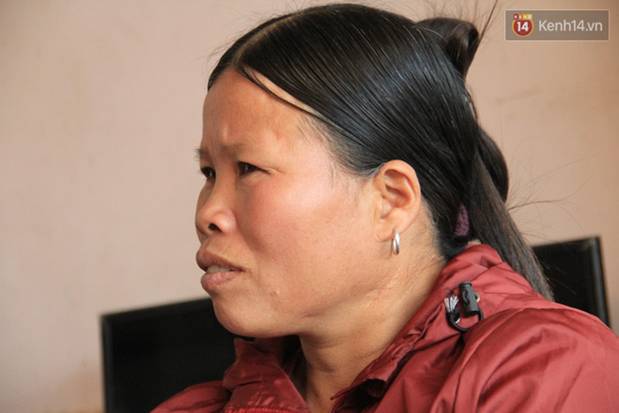 Nghẹn lòng cậu bé bị bệnh mặt quỷ”: Nó không dám đi học, bạn bè thấy thì chạy hết, cứ lủi thủi một mình như thế từ bé đến giờ”-3