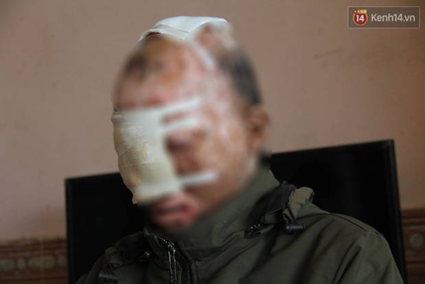 Nghẹn lòng cậu bé bị bệnh mặt quỷ”: Nó không dám đi học, bạn bè thấy thì chạy hết, cứ lủi thủi một mình như thế từ bé đến giờ”-4