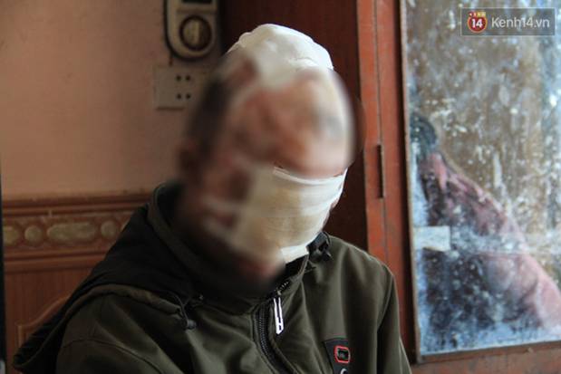 Nghẹn lòng cậu bé bị bệnh mặt quỷ”: Nó không dám đi học, bạn bè thấy thì chạy hết, cứ lủi thủi một mình như thế từ bé đến giờ”-6