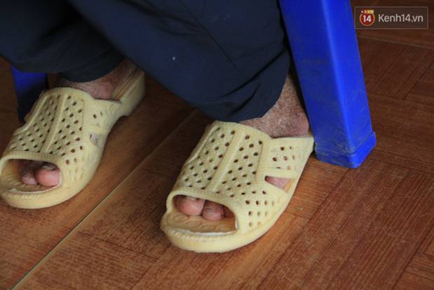 Nghẹn lòng cậu bé bị bệnh mặt quỷ”: Nó không dám đi học, bạn bè thấy thì chạy hết, cứ lủi thủi một mình như thế từ bé đến giờ”-8