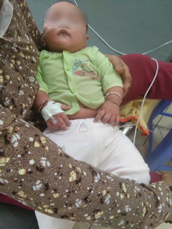 Lại có trường hợp bé gái 4 tháng tuổi tử vong sau khi chữa ho sai cách: Đâu là cách xử lý đúng nhất khi trẻ sơ sinh bị ho?-2