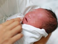 Lại có trường hợp bé gái 4 tháng tuổi tử vong sau khi chữa ho sai cách: Đâu là cách xử lý đúng nhất khi trẻ sơ sinh bị ho?