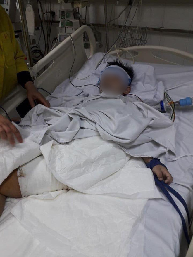 Xót thương hoàn cảnh 2 cháu bé bị cán nát chân trên đường đi học về: Con muốn khoẻ để lại đến trường...-2